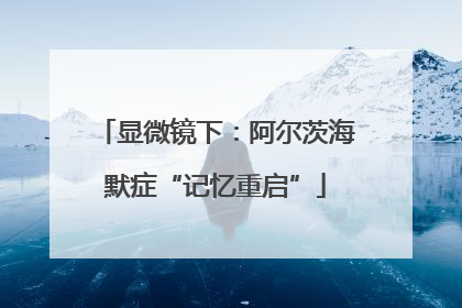 显微镜下：阿尔茨海默症“记忆重启”